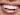 teeth-whitening-laser-use